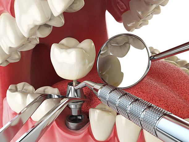 Best Walk-In Emergency Dentist in Rosebud, TX