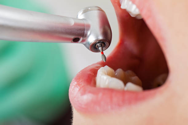Best Weekend Emergency Dentist in Rosebud, TX